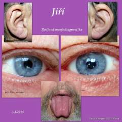 Rodiná fotodiagnostika